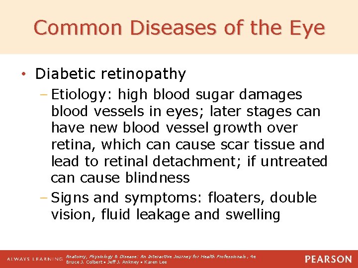 Common Diseases of the Eye • Diabetic retinopathy – Etiology: high blood sugar damages