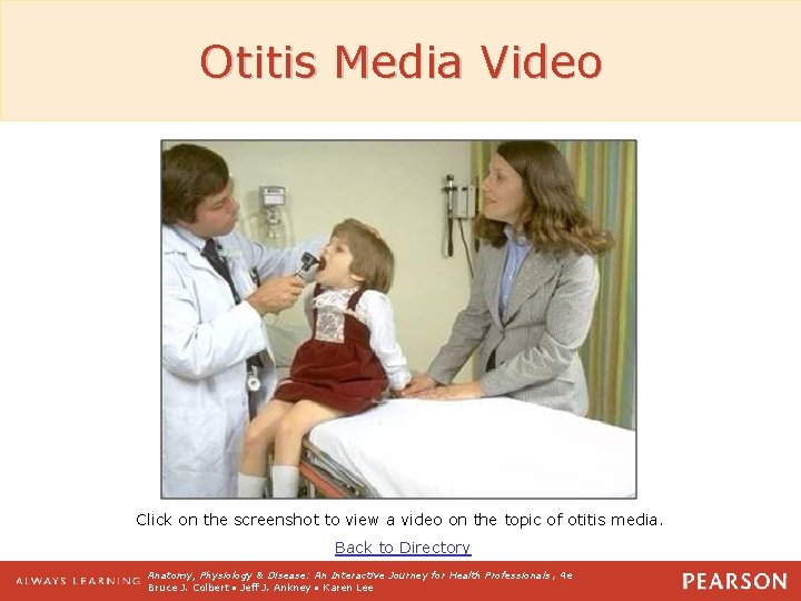 Otitis Media Video Click on the screenshot to view a video on the topic