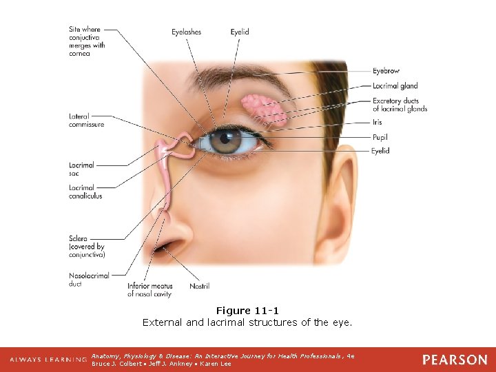 Figure 11 -1 External and lacrimal structures of the eye. Anatomy, Physiology & Disease: