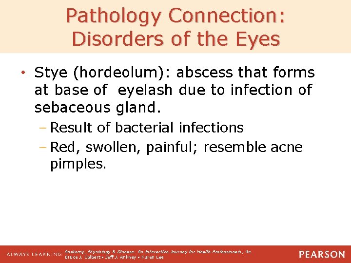 Pathology Connection: Disorders of the Eyes • Stye (hordeolum): abscess that forms at base