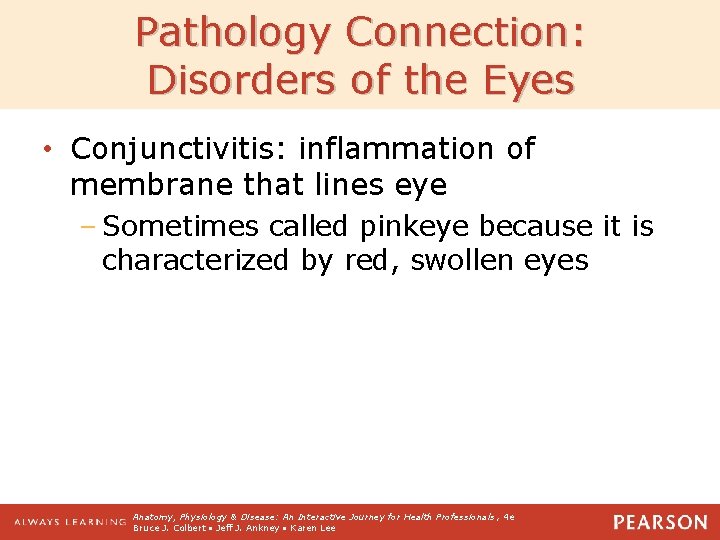 Pathology Connection: Disorders of the Eyes • Conjunctivitis: inflammation of membrane that lines eye