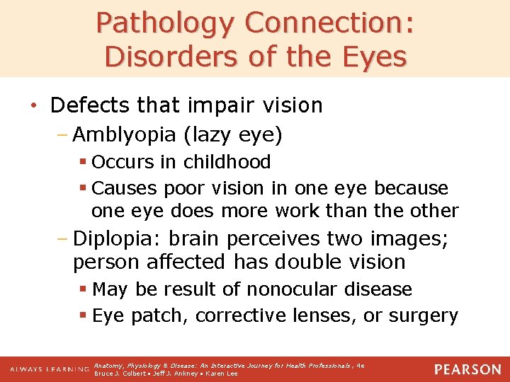 Pathology Connection: Disorders of the Eyes • Defects that impair vision – Amblyopia (lazy