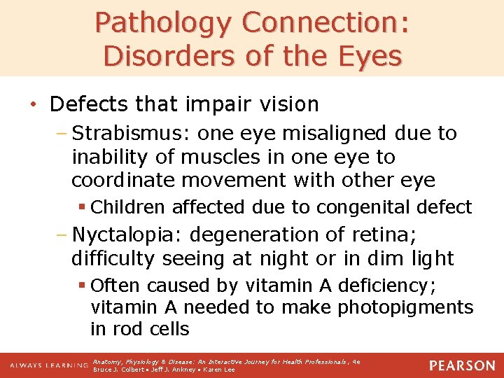 Pathology Connection: Disorders of the Eyes • Defects that impair vision – Strabismus: one