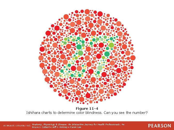 Figure 11 -4 Ishihara charts to determine color blindness. Can you see the number?