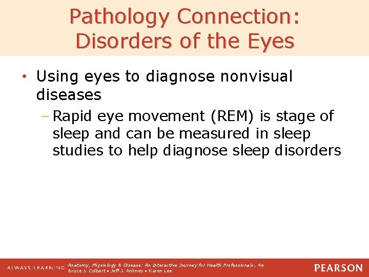 Pathology Connection: Disorders of the Eyes • Using eyes to diagnose nonvisual diseases –