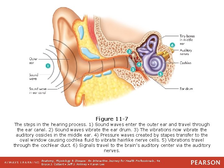 Figure 11 -7 The steps in the hearing process. 1) Sound waves enter the