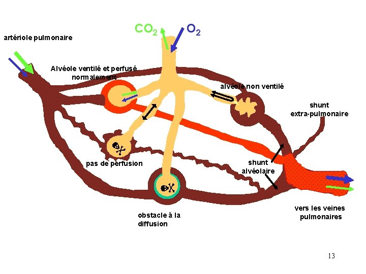 CO 2 artériole pulmonaire O 2 Alvéole ventilé et perfusé normalement alvéole non ventilé