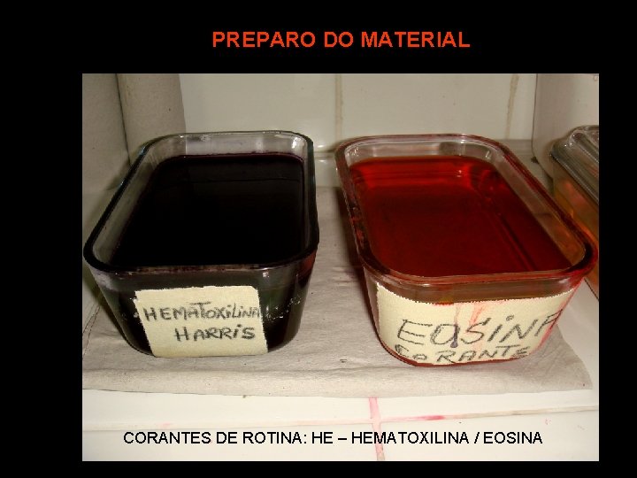 PREPARO DO MATERIAL CORANTES DE ROTINA: HE – HEMATOXILINA / EOSINA 