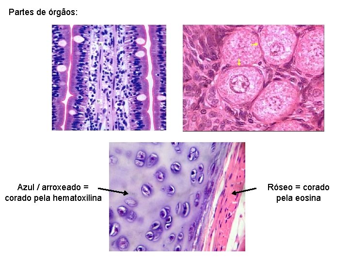 Partes de órgãos: Azul / arroxeado = corado pela hematoxilina Róseo = corado pela