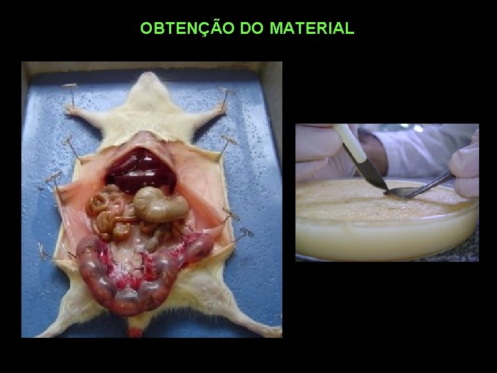 OBTENÇÃO DO MATERIAL 