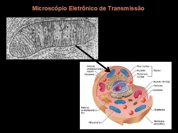 Microscópio Eletrônico de Transmissão 