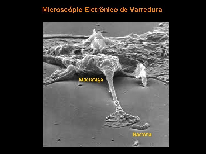 Microscópio Eletrônico de Varredura Macrófago Bactéria 