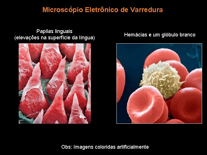 Microscópio Eletrônico de Varredura Papilas linguais (elevações na superfície da língua) Hemácias e um