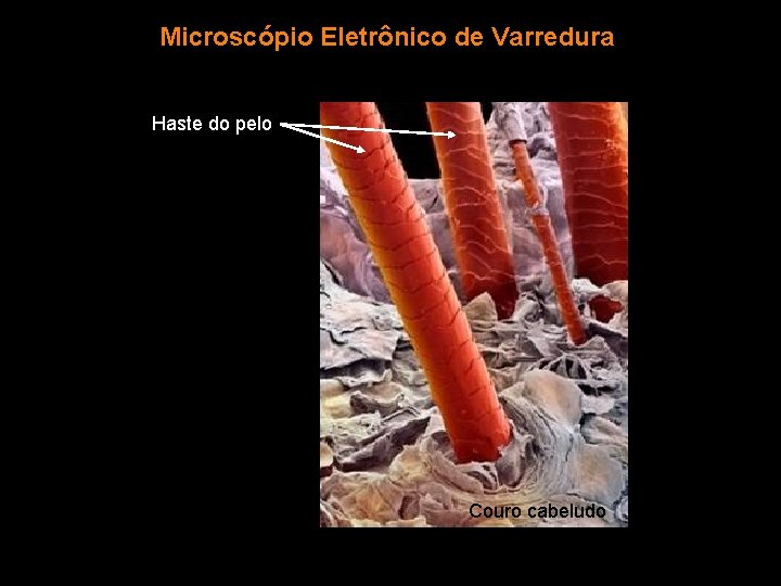 Microscópio Eletrônico de Varredura Haste do pelo Couro cabeludo 