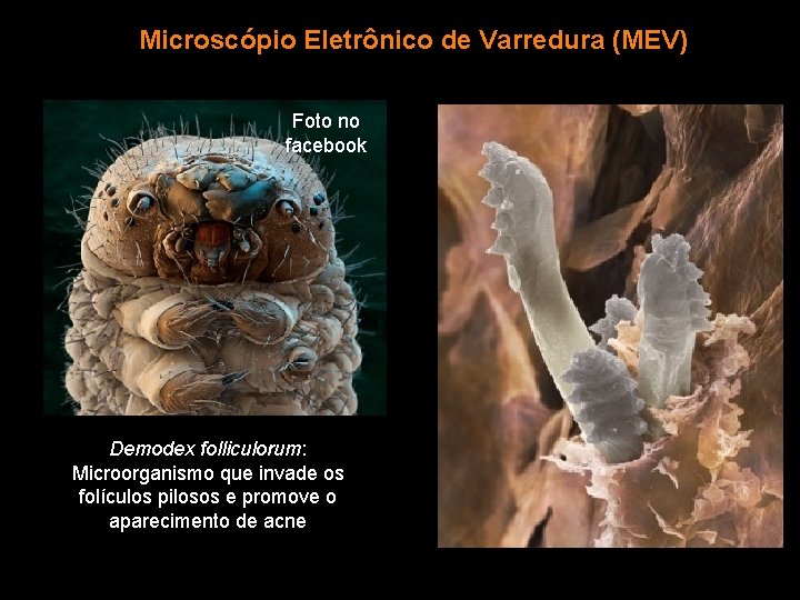 Microscópio Eletrônico de Varredura (MEV) Foto no facebook Demodex folliculorum: Microorganismo que invade os