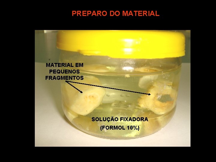 PREPARO DO MATERIAL EM PEQUENOS FRAGMENTOS SOLUÇÃO FIXADORA (FORMOL 10%) 