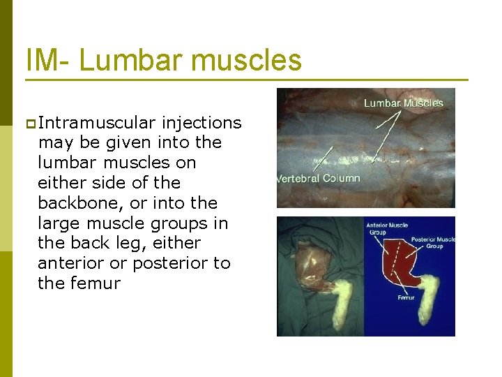 IM- Lumbar muscles p Intramuscular injections may be given into the lumbar muscles on