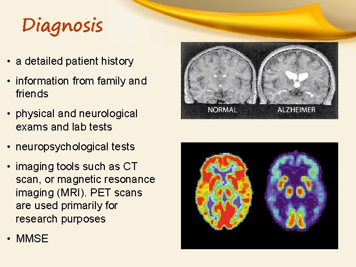 Diagnosis • a detailed patient history • information from family and friends • physical