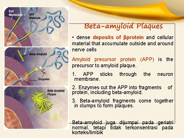 Beta-amyloid Plaques • dense deposits of βprotein and cellular material that accumulate outside and