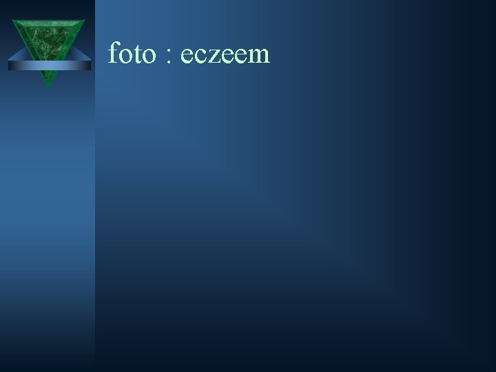 foto : eczeem 