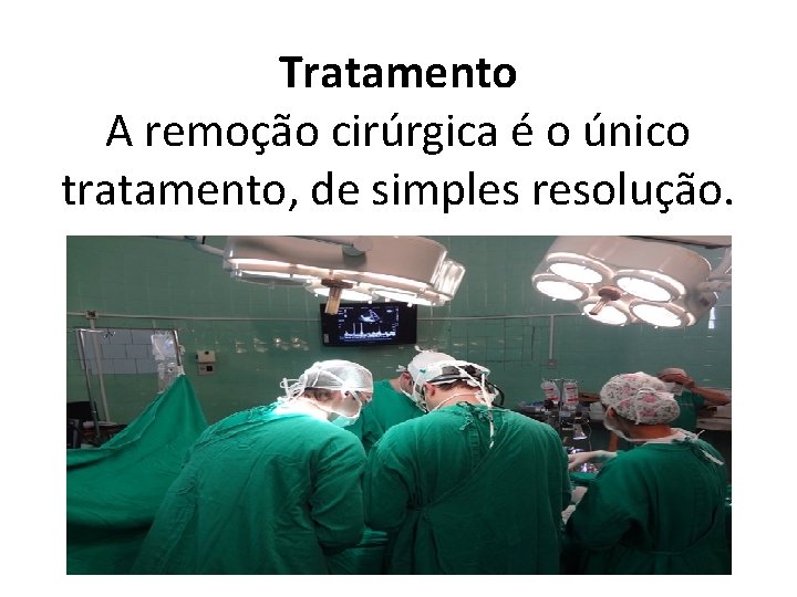 Tratamento A remoção cirúrgica é o único tratamento, de simples resolução. 