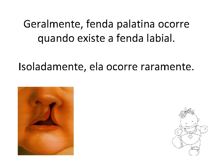 Geralmente, fenda palatina ocorre quando existe a fenda labial. Isoladamente, ela ocorre raramente. 