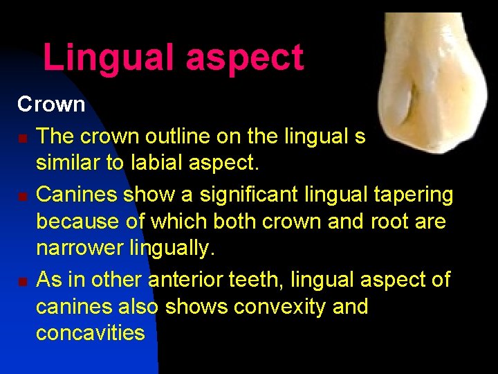 Lingual aspect Crown n The crown outline on the lingual side is similar to