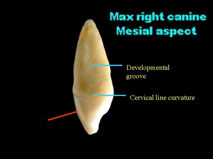 Developmental groove Cervical line curvature 