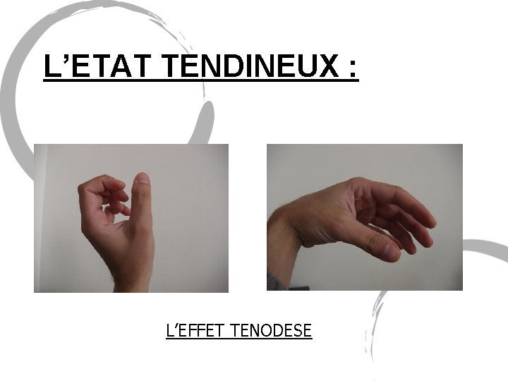 L’ETAT TENDINEUX : L’EFFET TENODESE 