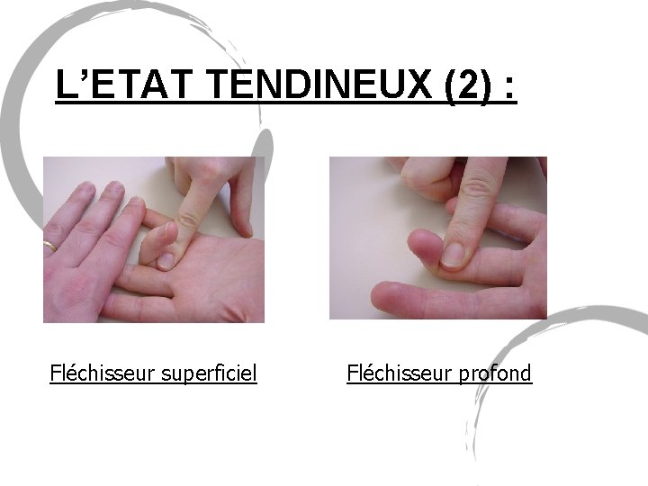 L’ETAT TENDINEUX (2) : Fléchisseur superficiel Fléchisseur profond 