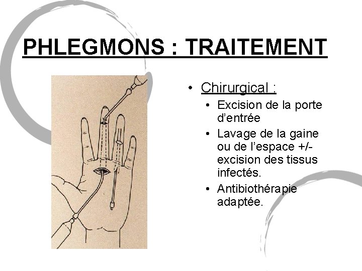 PHLEGMONS : TRAITEMENT • Chirurgical : • Excision de la porte d’entrée • Lavage
