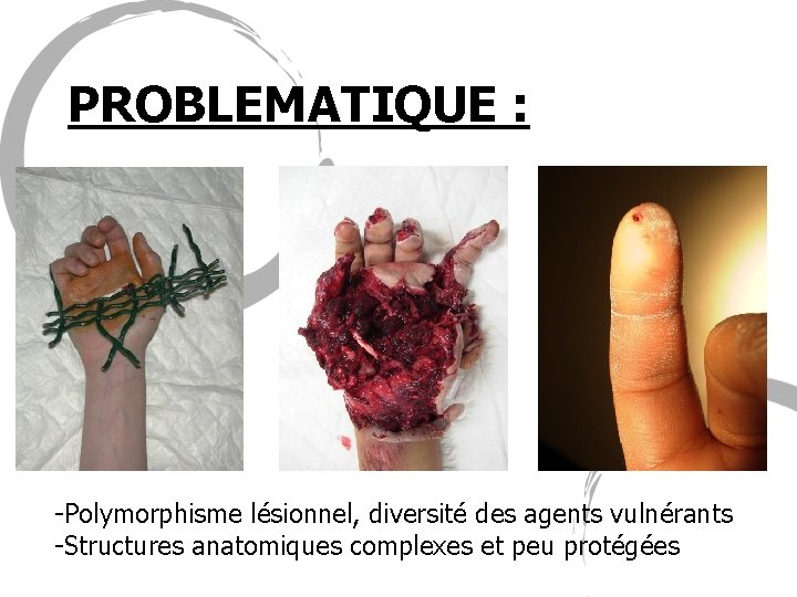 PROBLEMATIQUE : -Polymorphisme lésionnel, diversité des agents vulnérants -Structures anatomiques complexes et peu protégées