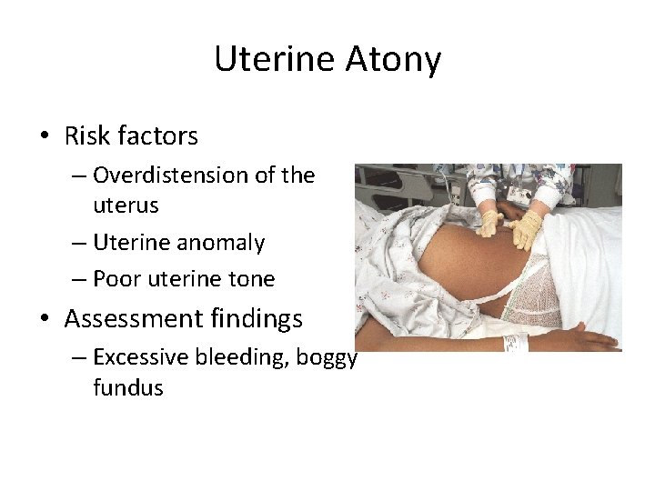 Uterine Atony • Risk factors – Overdistension of the uterus – Uterine anomaly –