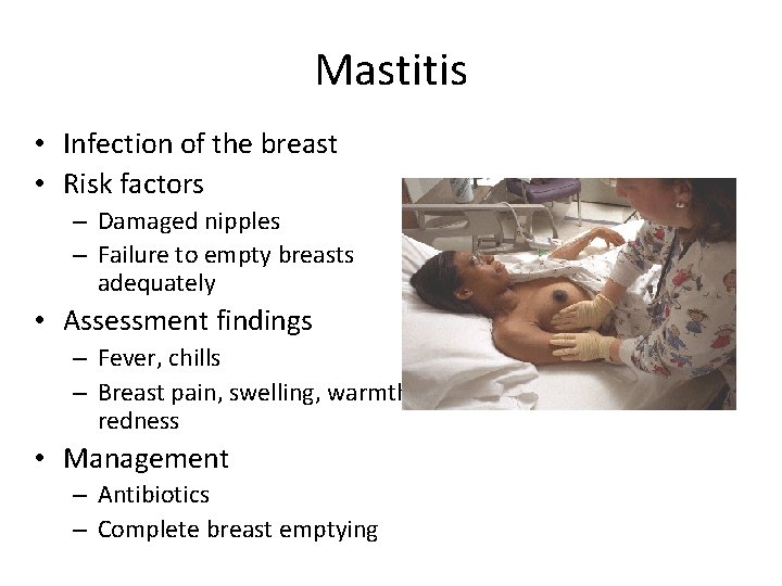 Mastitis • Infection of the breast • Risk factors – Damaged nipples – Failure
