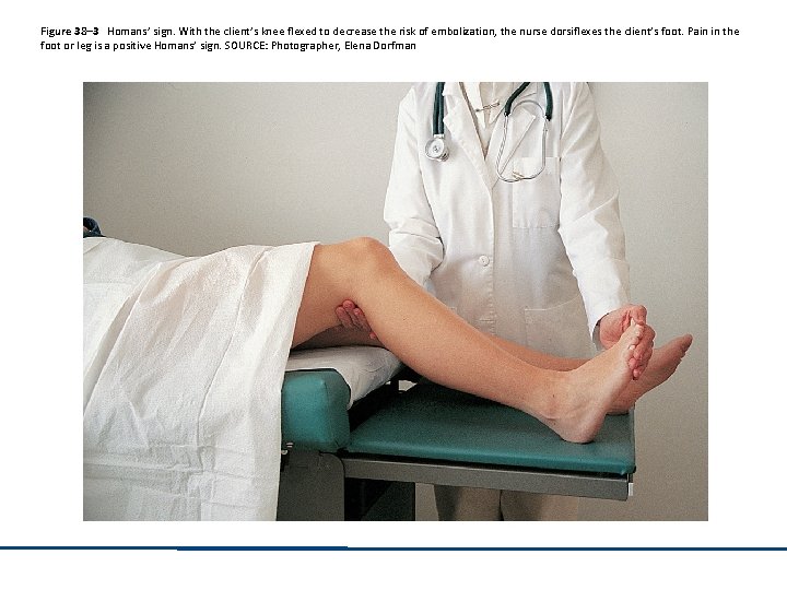 Figure 38– 3 Homans’ sign. With the client’s knee flexed to decrease the risk