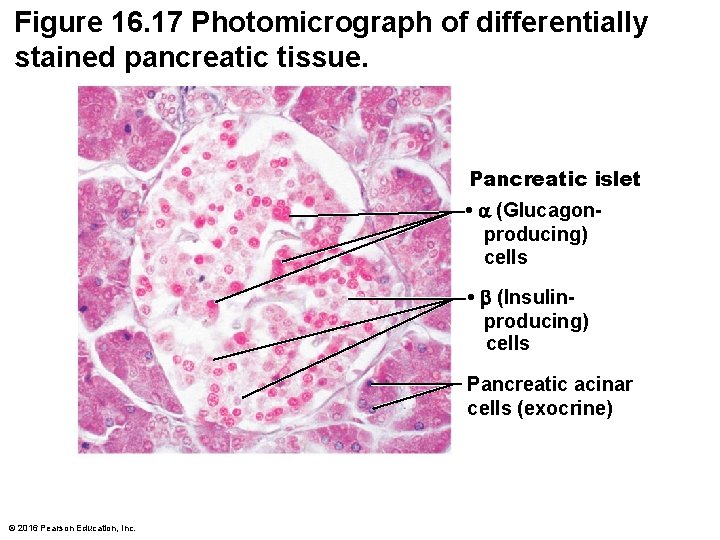 Figure 16. 17 Photomicrograph of differentially stained pancreatic tissue. Pancreatic islet • (Glucagonproducing) cells