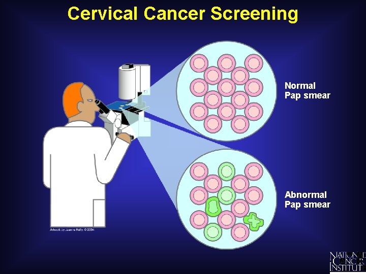 Cervical Cancer Screening Normal Pap smear Abnormal Pap smear 