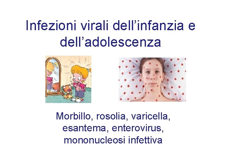 Infezioni virali dell’infanzia e dell’adolescenza Morbillo, rosolia, varicella, esantema, enterovirus, mononucleosi infettiva 