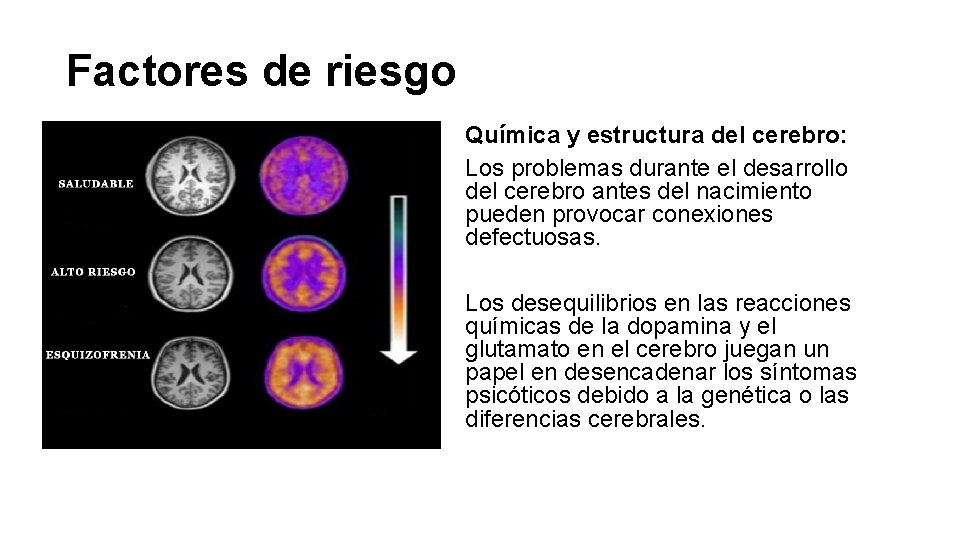 Factores de riesgo Química y estructura del cerebro: Los problemas durante el desarrollo del