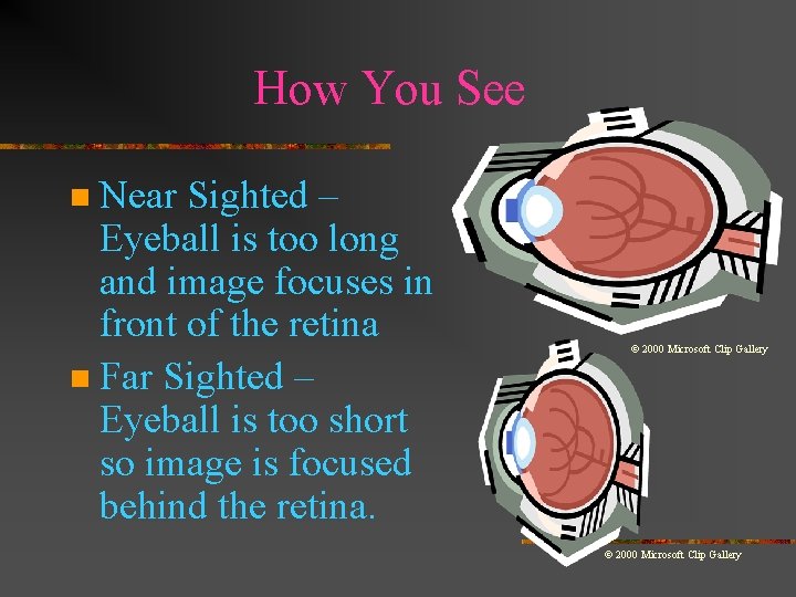 How You See Near Sighted – Eyeball is too long and image focuses in
