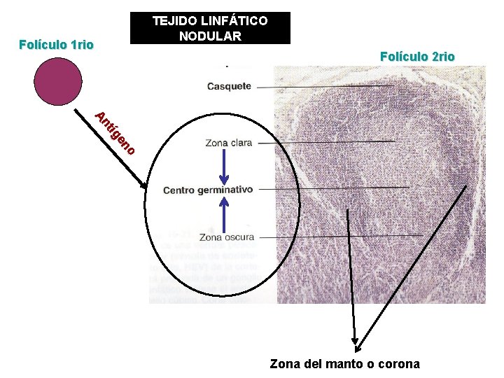 Folículo 1 rio TEJIDO LINFÁTICO NODULAR Folículo 2 rio o en tíg An Zona