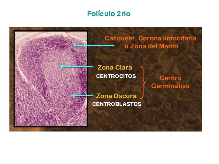 Folículo 2 rio CENTROCITOS CENTROBLASTOS 