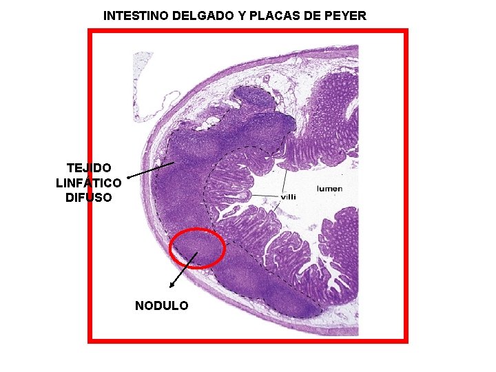 INTESTINO DELGADO Y PLACAS DE PEYER TEJIDO LINFÁTICO DIFUSO NODULO 