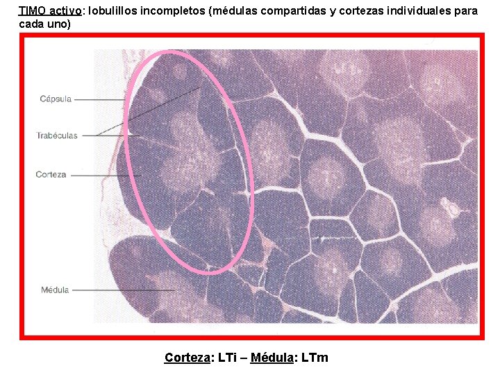 TIMO activo: lobulillos incompletos (médulas compartidas y cortezas individuales para cada uno) Corteza: LTi
