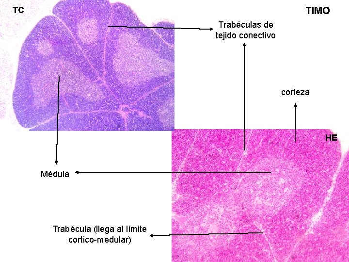 TC TIMO Trabéculas de tejido conectivo corteza HE Médula Trabécula (llega al límite cortico-medular)