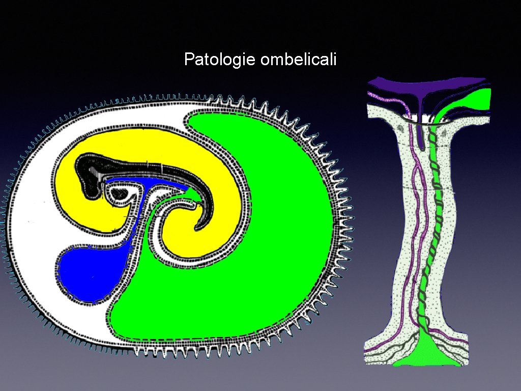 Patologie ombelicali 