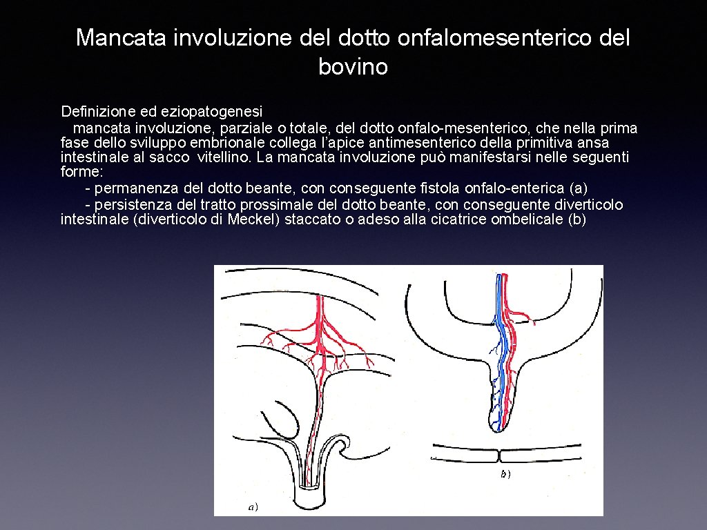 Mancata involuzione del dotto onfalomesenterico del bovino Definizione ed eziopatogenesi mancata involuzione, parziale o