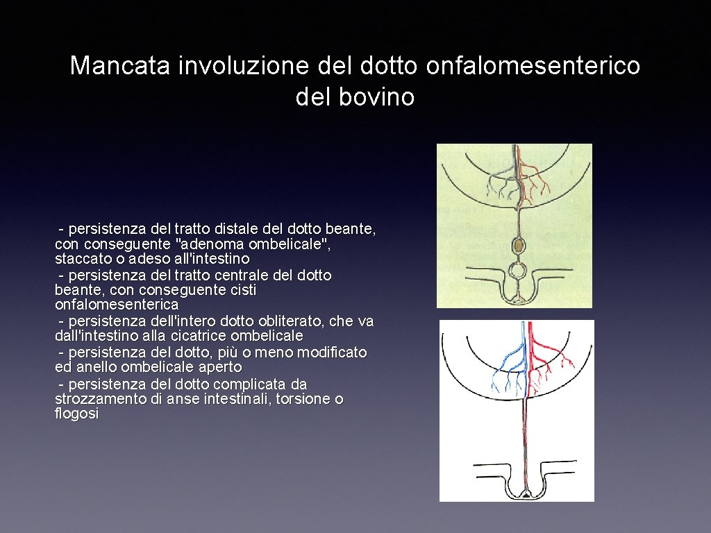 Mancata involuzione del dotto onfalomesenterico del bovino - persistenza del tratto distale del dotto