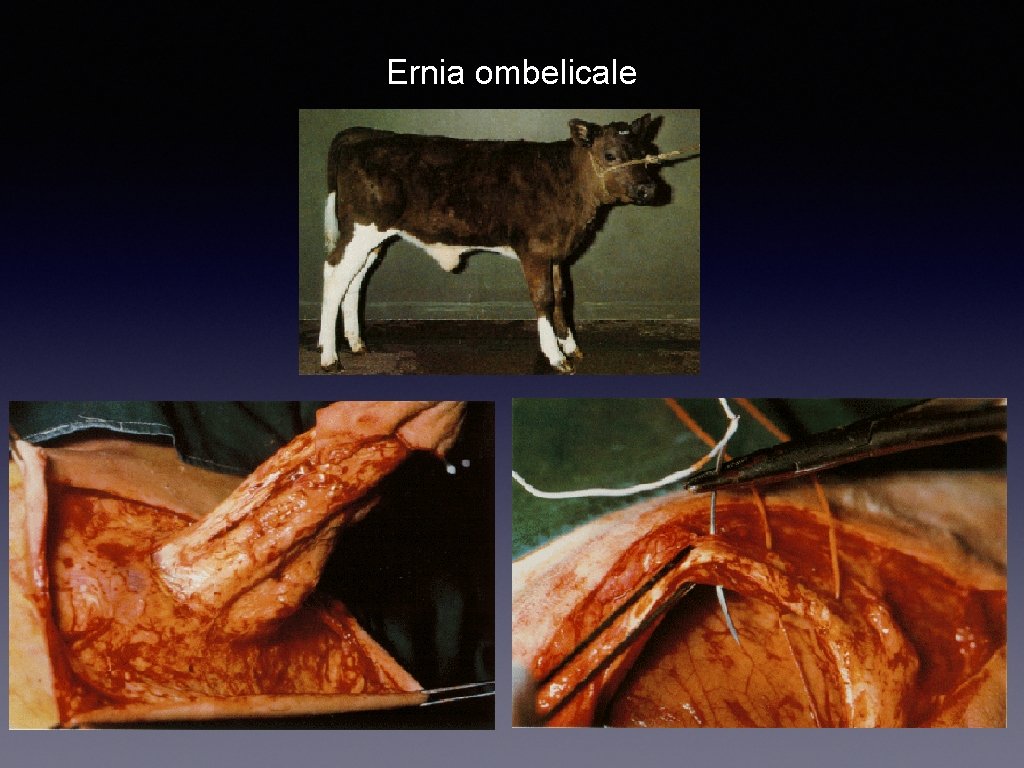 Ernia ombelicale 