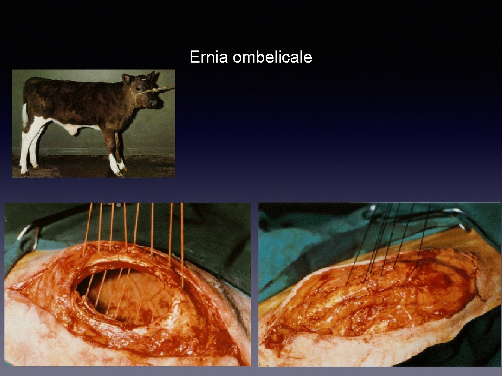 Ernia ombelicale 